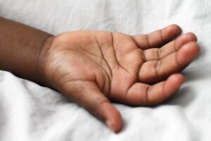 白髪ケアで皮膚についた色素の落とし方は？