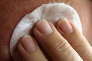 白髪ケアは抗がん剤後の生え始めにどう相談すればいい？
